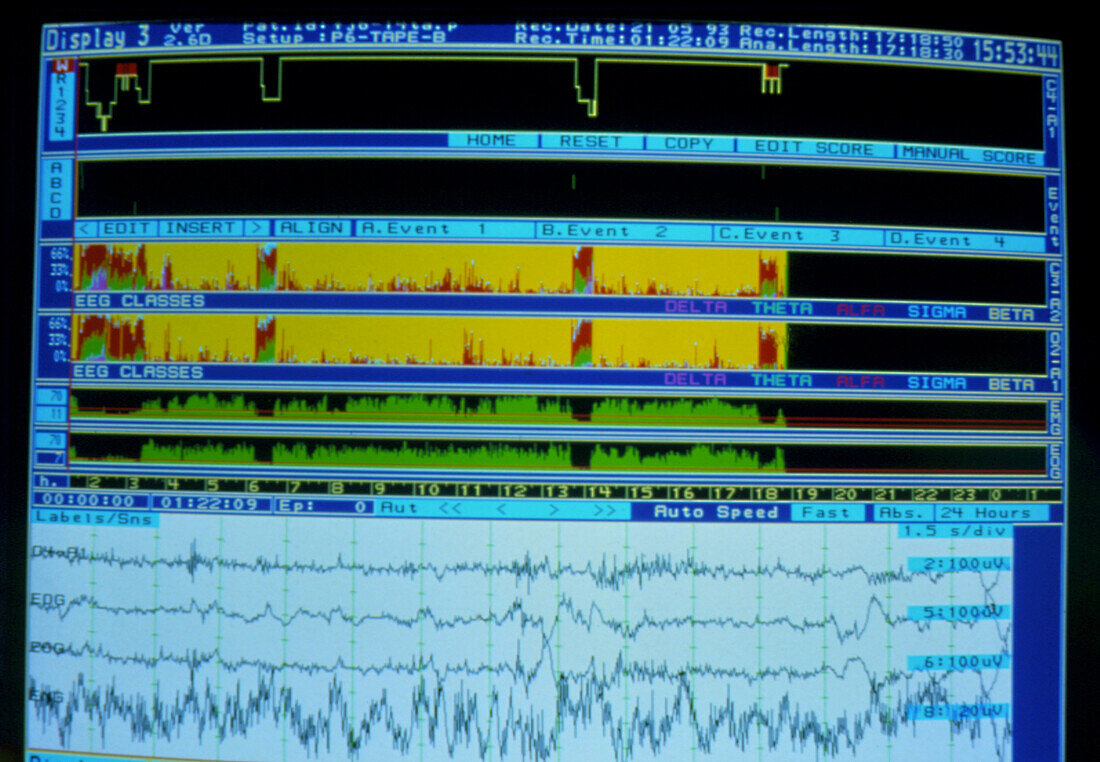 Brainwave (EEG) pattern during circadian research