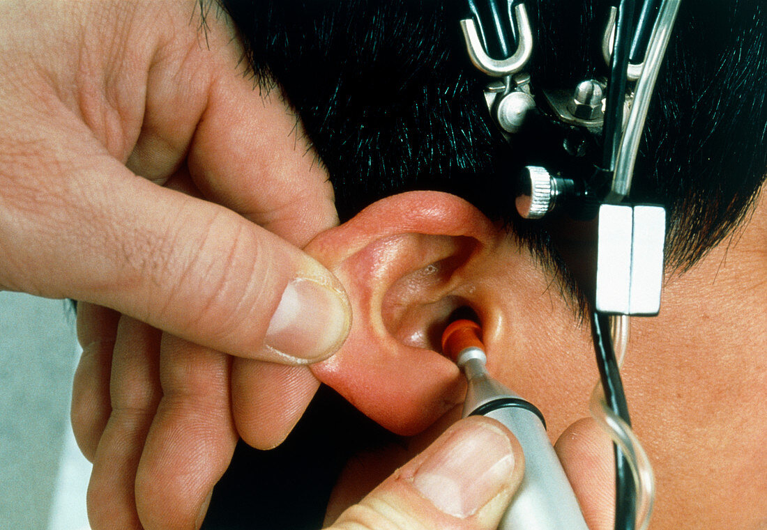 Patient having hearing test after cochlea