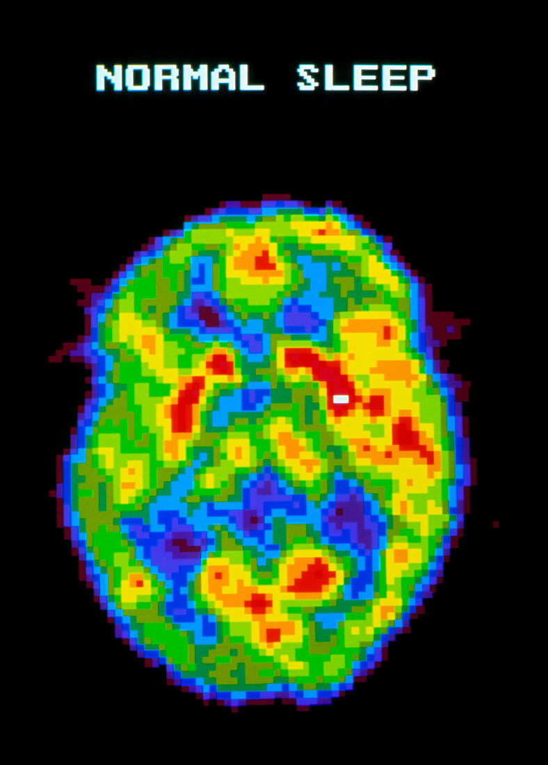 PET scan of a brain during normal sleep