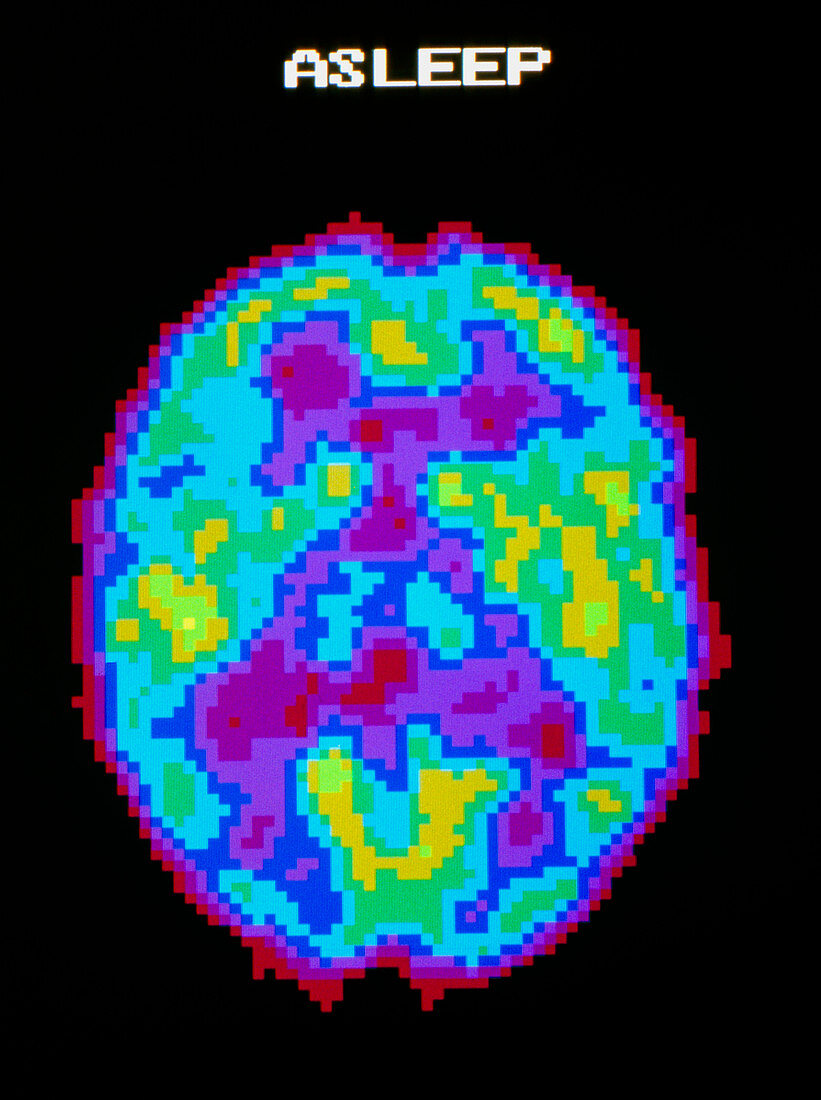 Coloured PET scan of brain during deep sleep