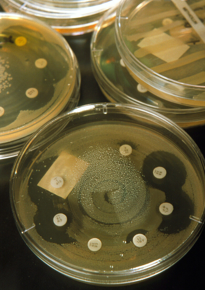 Petri dish bacterial antibiotic sensitivity