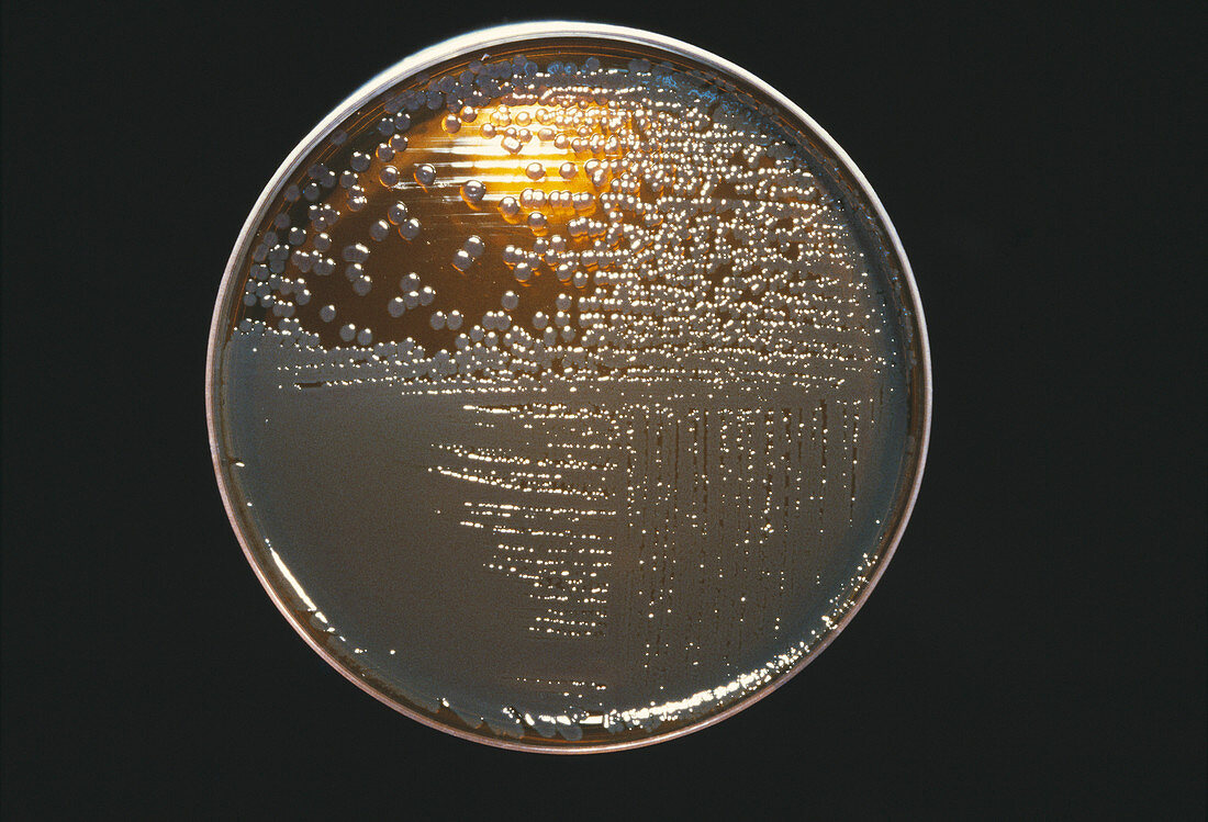 Cultured E. coli bacteria
