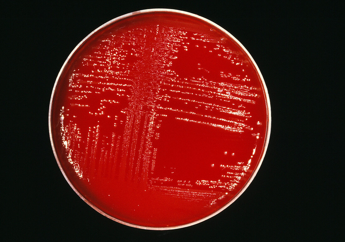 Cultured listeria bacteria