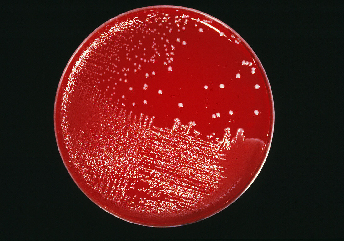 Cultured blood poisoning bacteria
