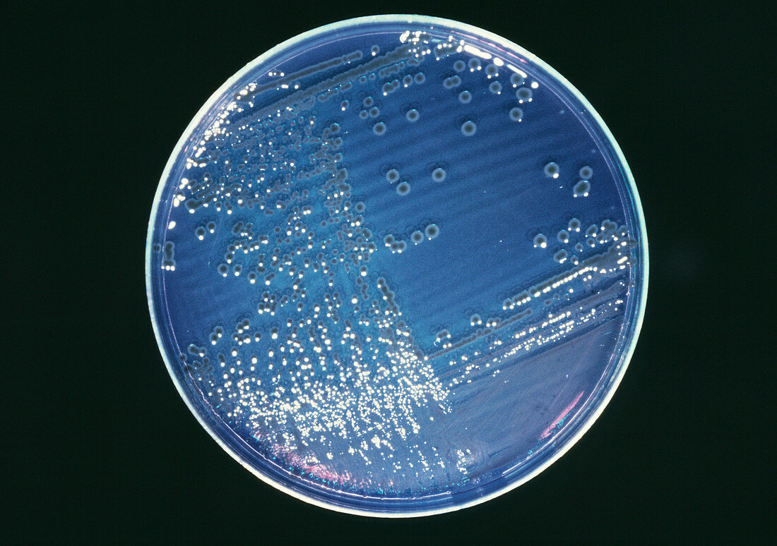 Cultured typhoid bacteria