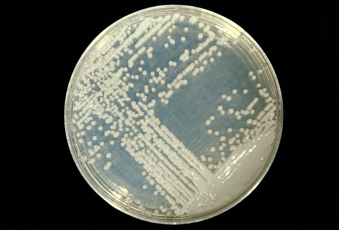 Cultured Cryptococcus fungus