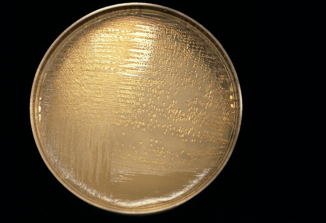 Cultured plague bacteria