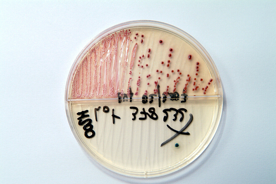 Staphylococcus bacterial culture