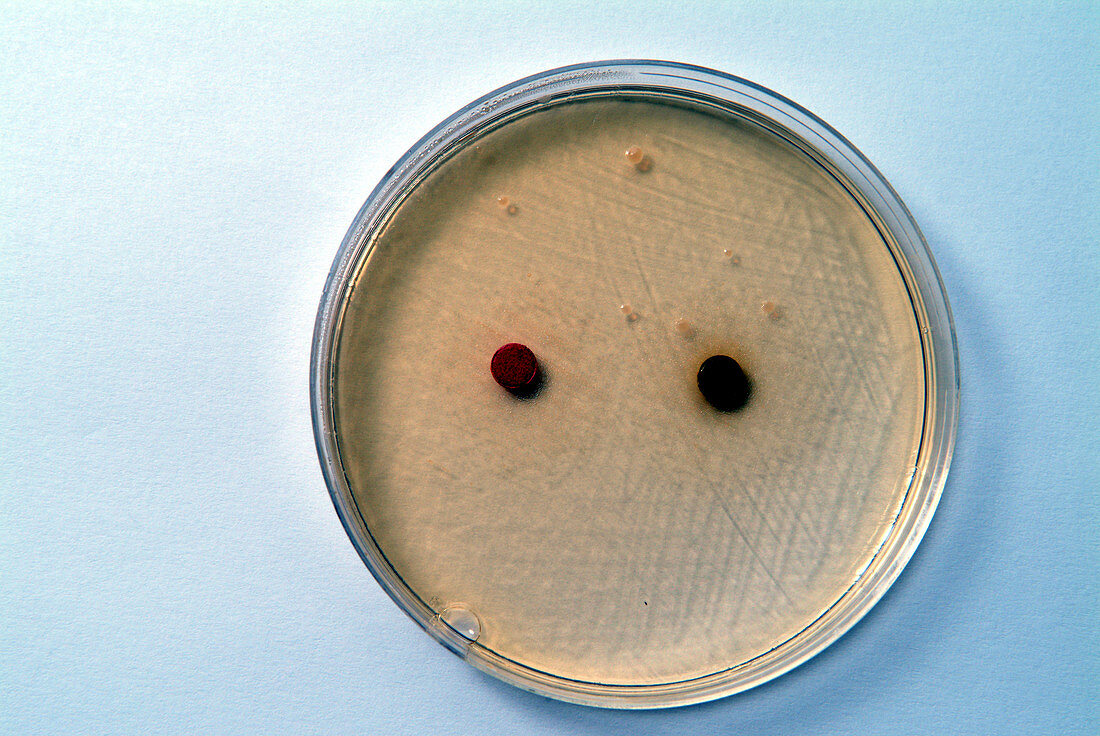 Haemophilus bacterial culture