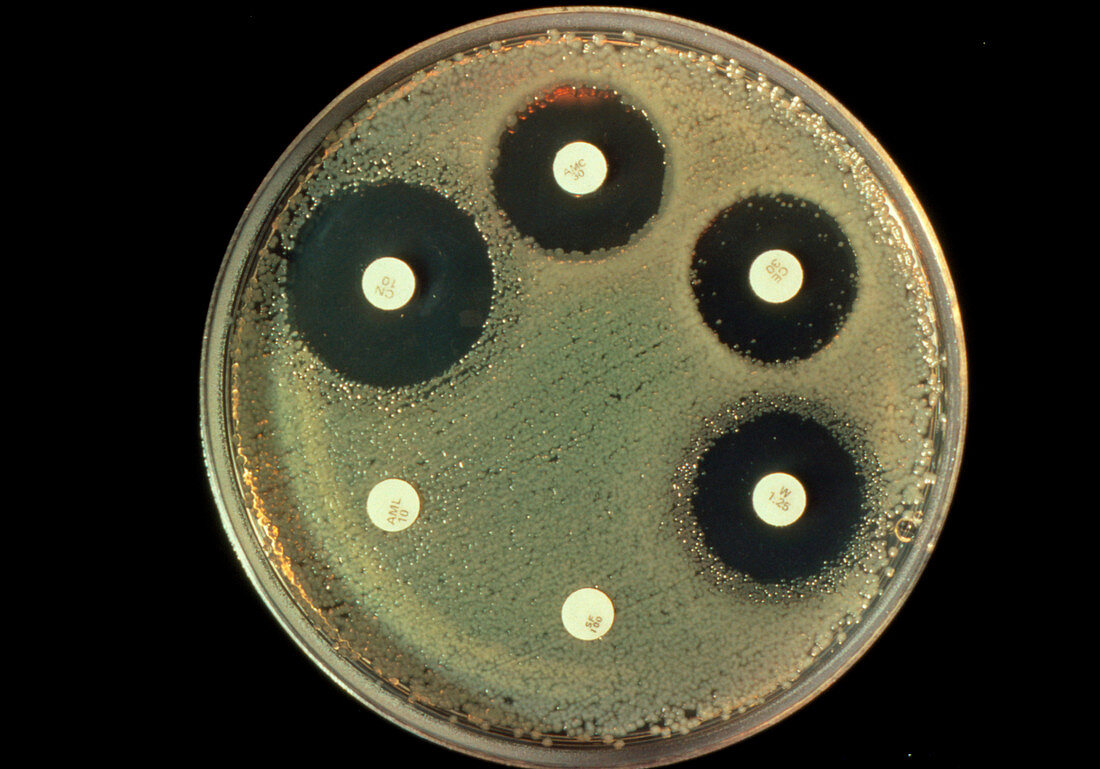 Antibiotic resistance in E. coli bacteria
