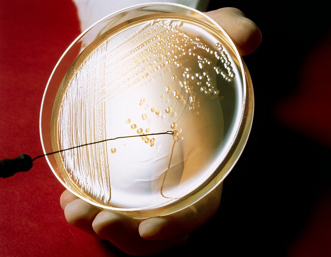 Petri dish culture of bacterium Escherichia coli