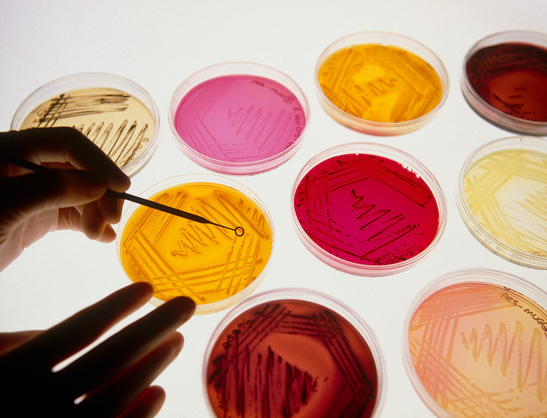 Petri dish bacterial cultures,picking a colony