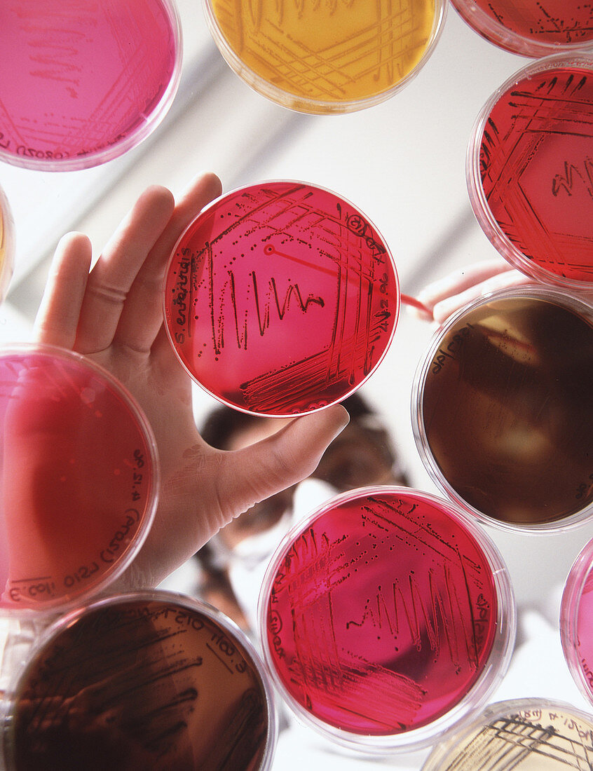 Petri dish bacterial cultures,picking colony