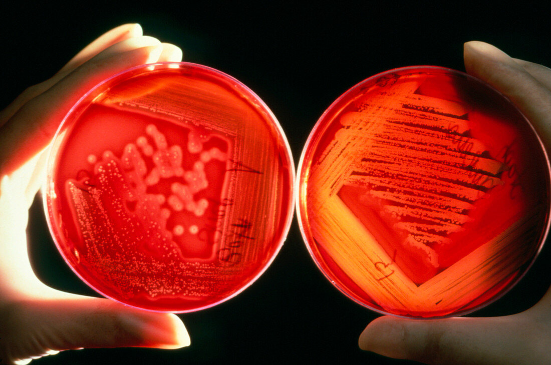Hands holding petri dishes with cultures