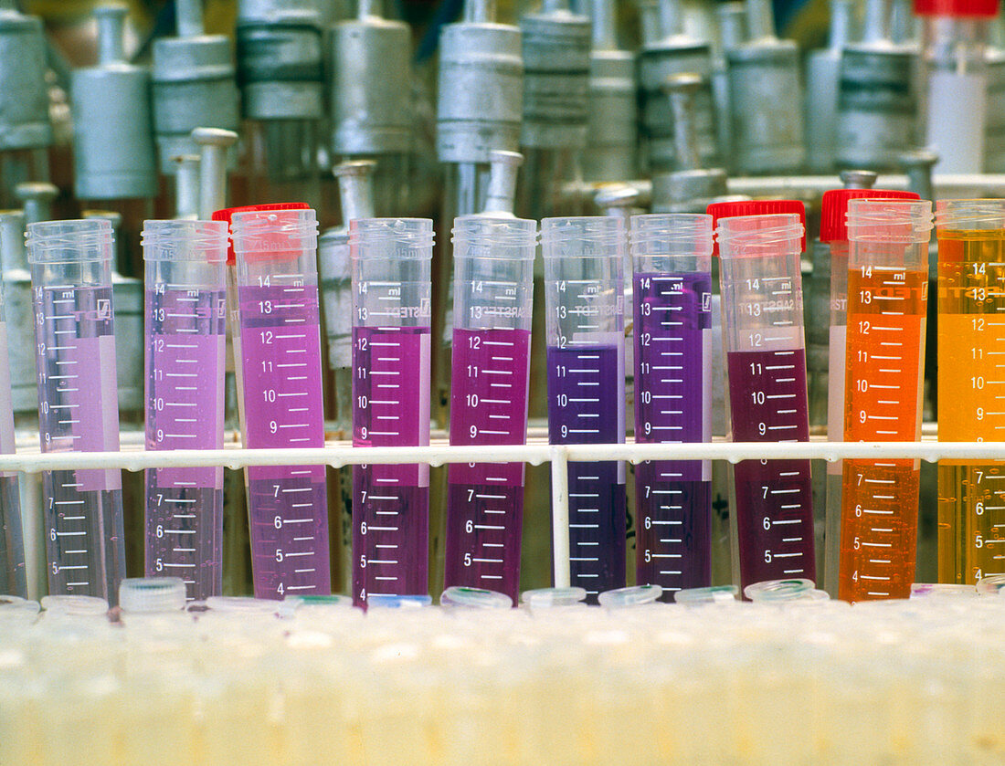 Test tubes of culture media of various colours