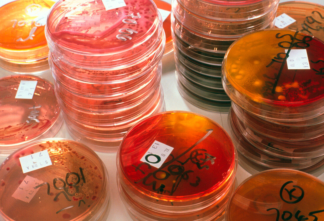 Stacks of petri dish faecal bacterial cultures