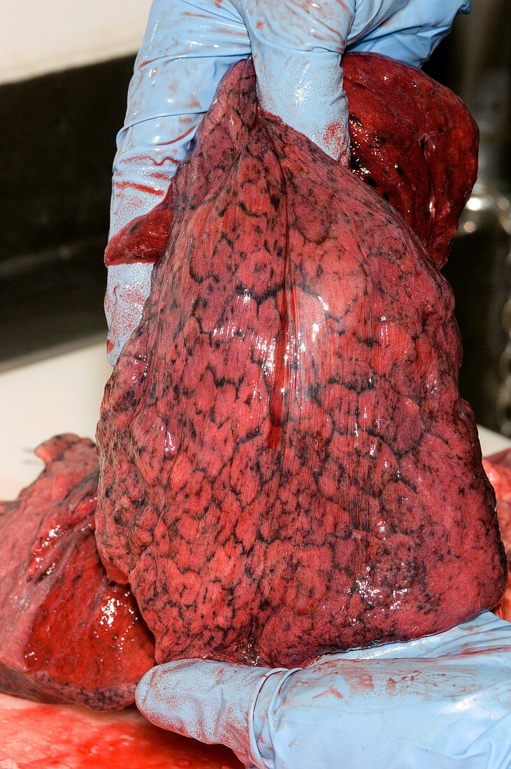 Lungs,post-mortem