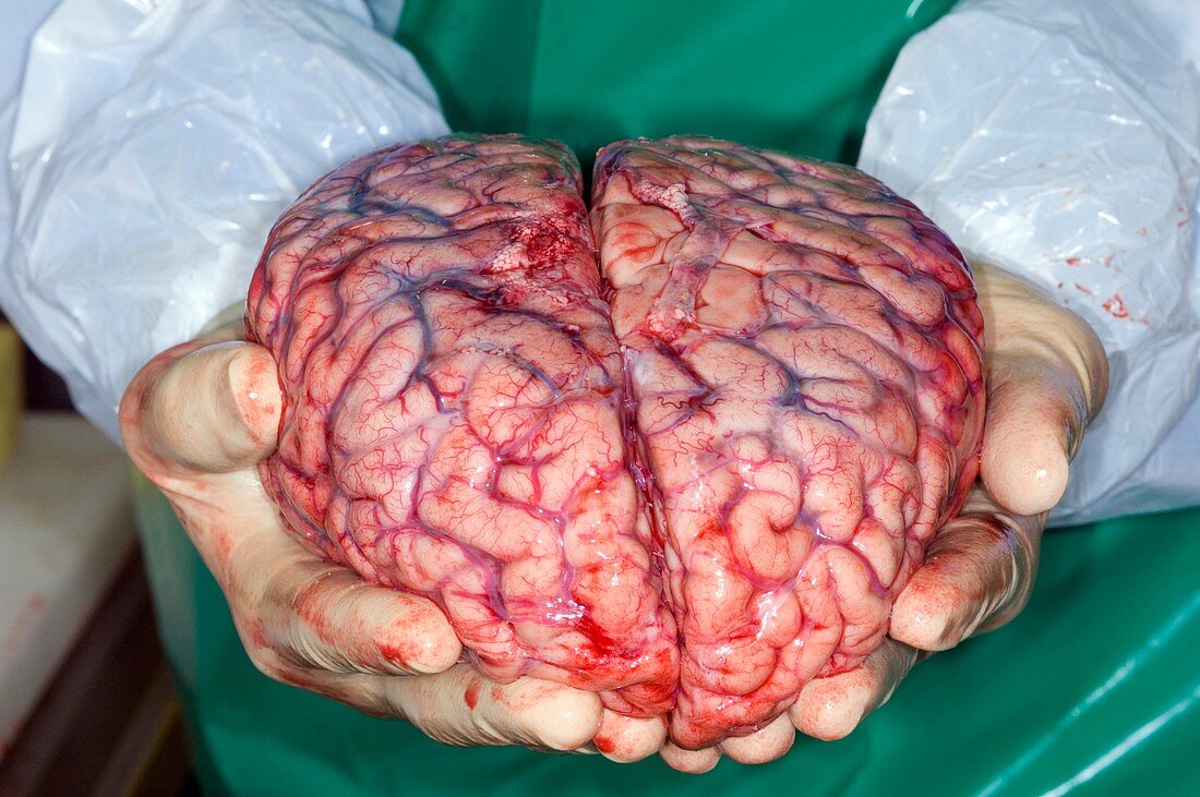 Brain,post-mortem