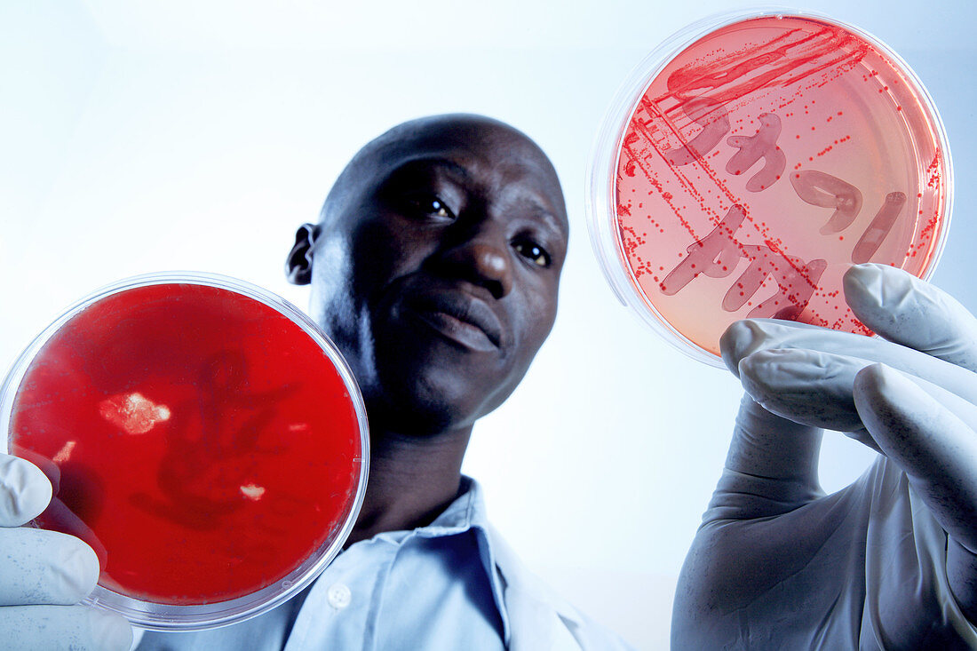 Staphylococcus bacteria research