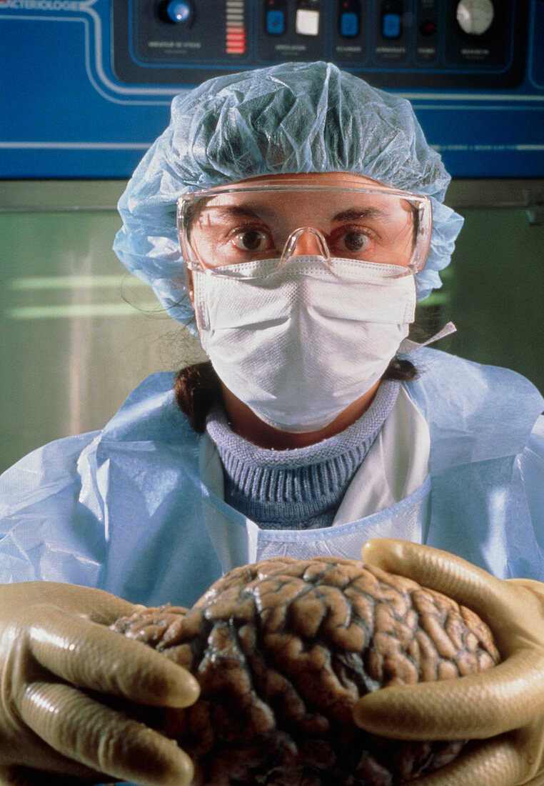 Pathologist holds human brain in CJD disease test