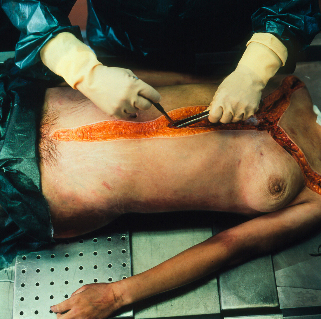 Autopsy examination