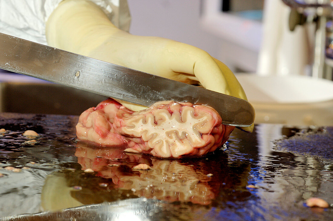 Technician dissecting a human brain