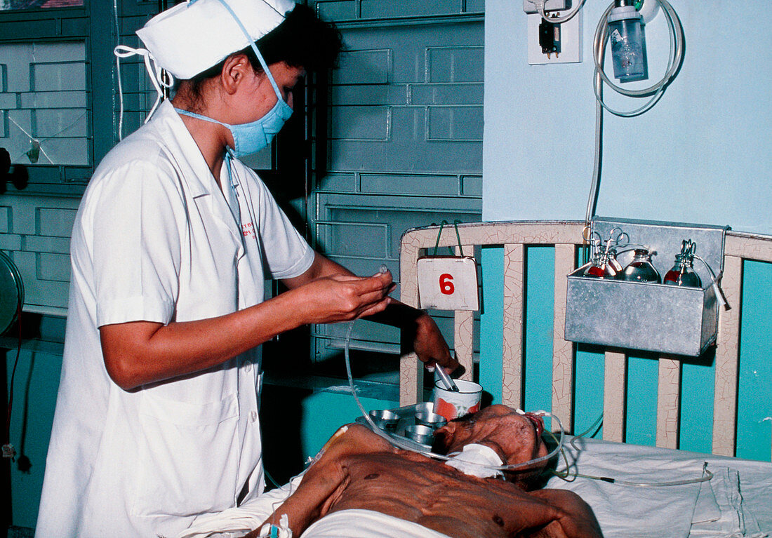 Nurse feeds man with tetanus in a Vietnam hospital