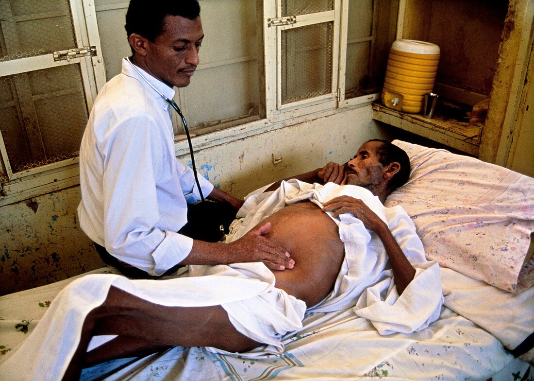 Doctor examining a man with schistosomiasis