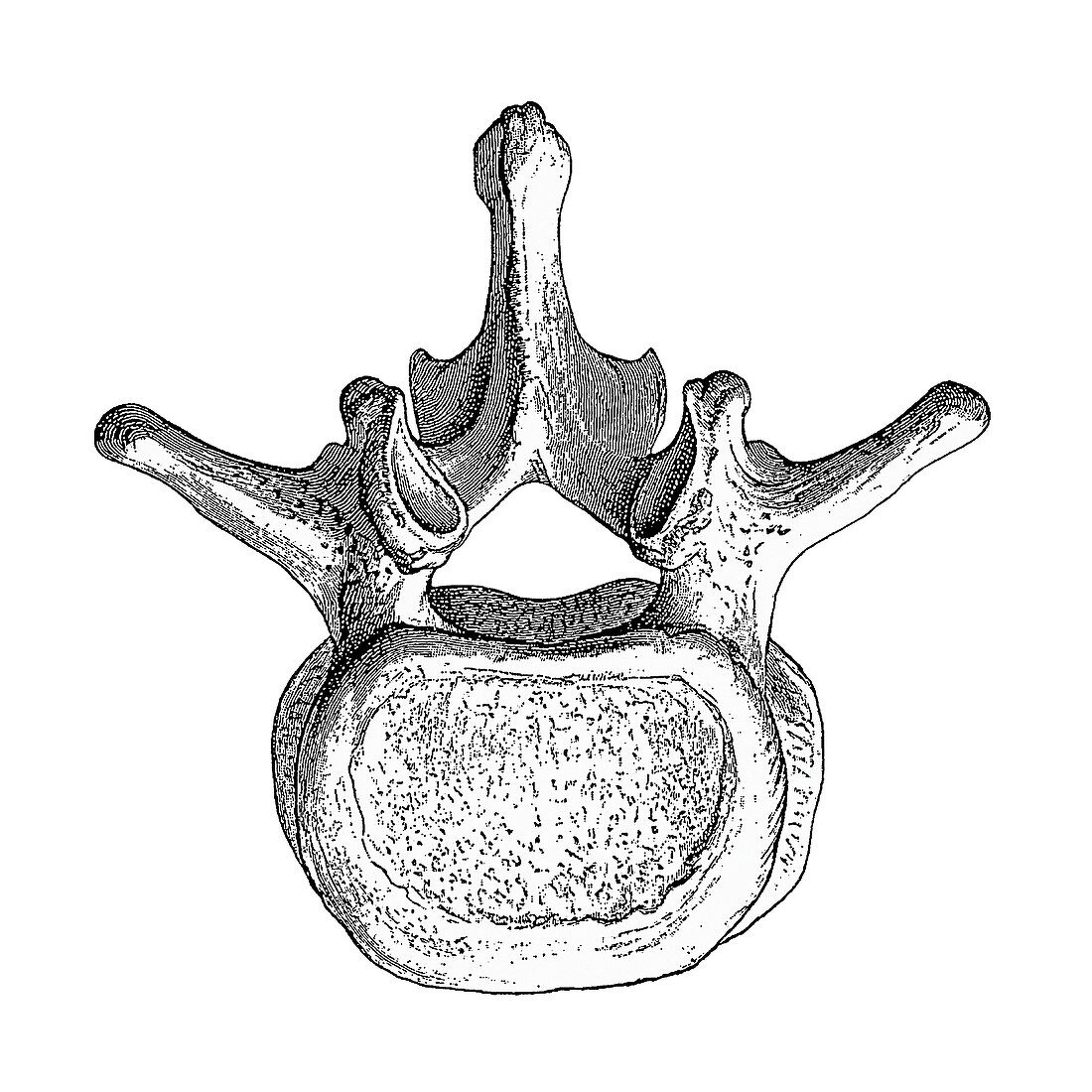 Spinal vertebra