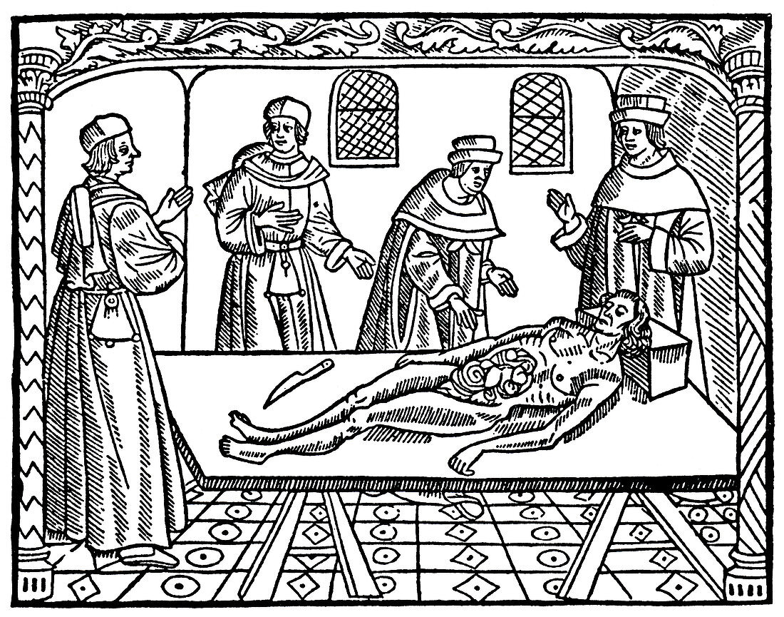 15th-century autopsy