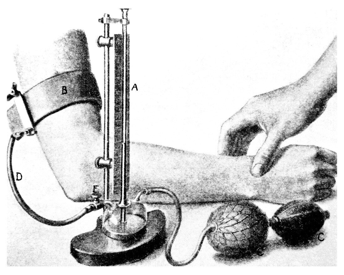 19th C sphygmomanometer measuring blood pressure