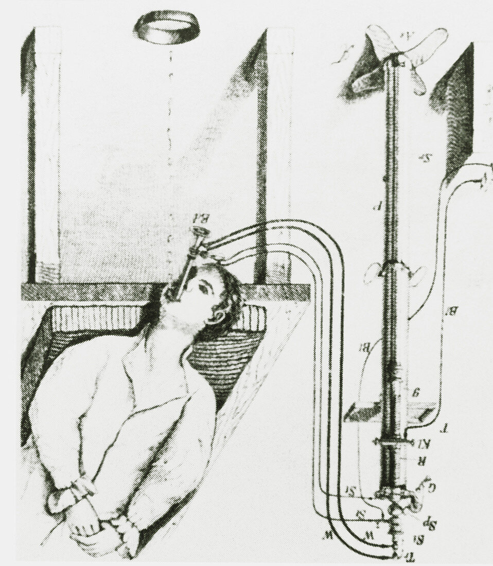 Historical artwork of the first useful gastroscope