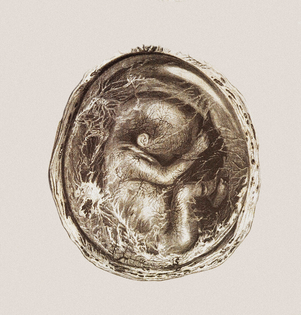 Foetus in the uterus