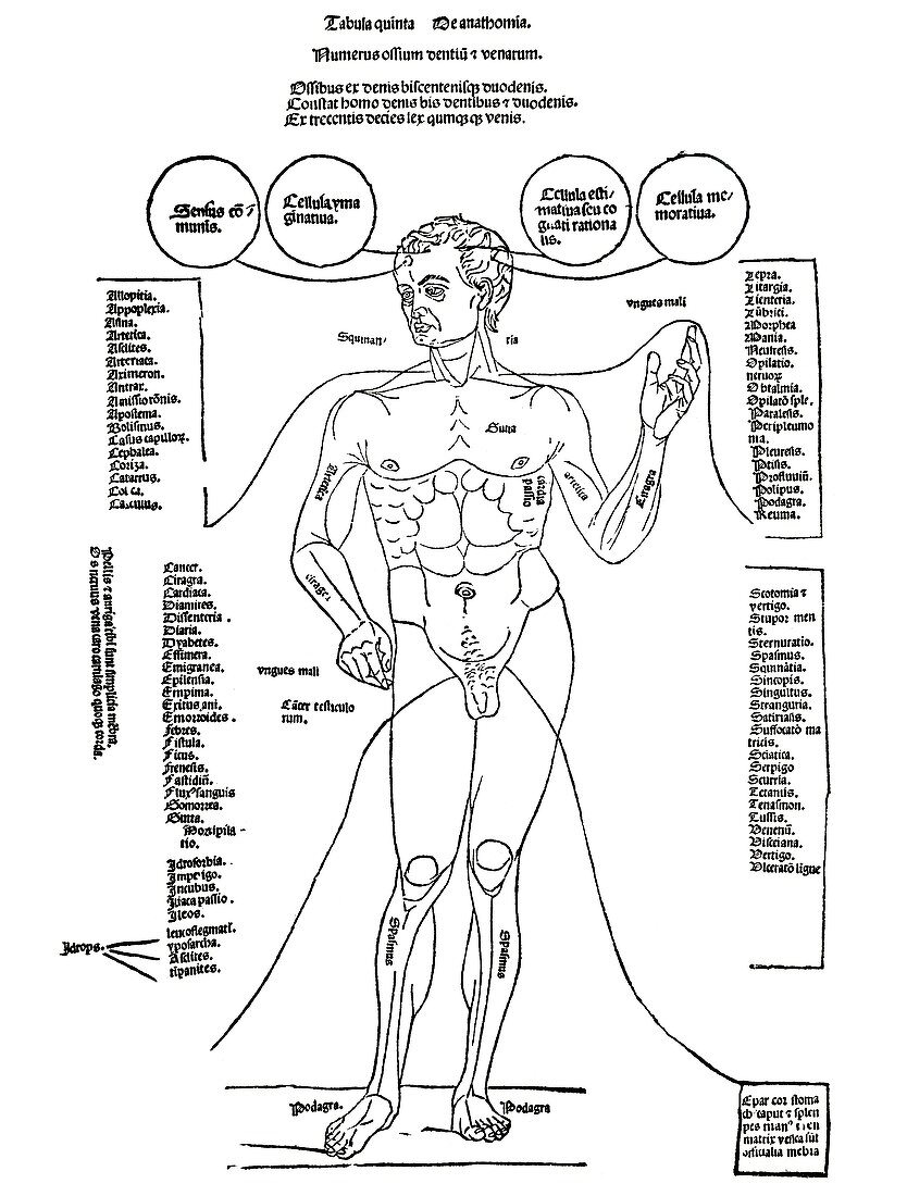 Common diseases,15th century diagram