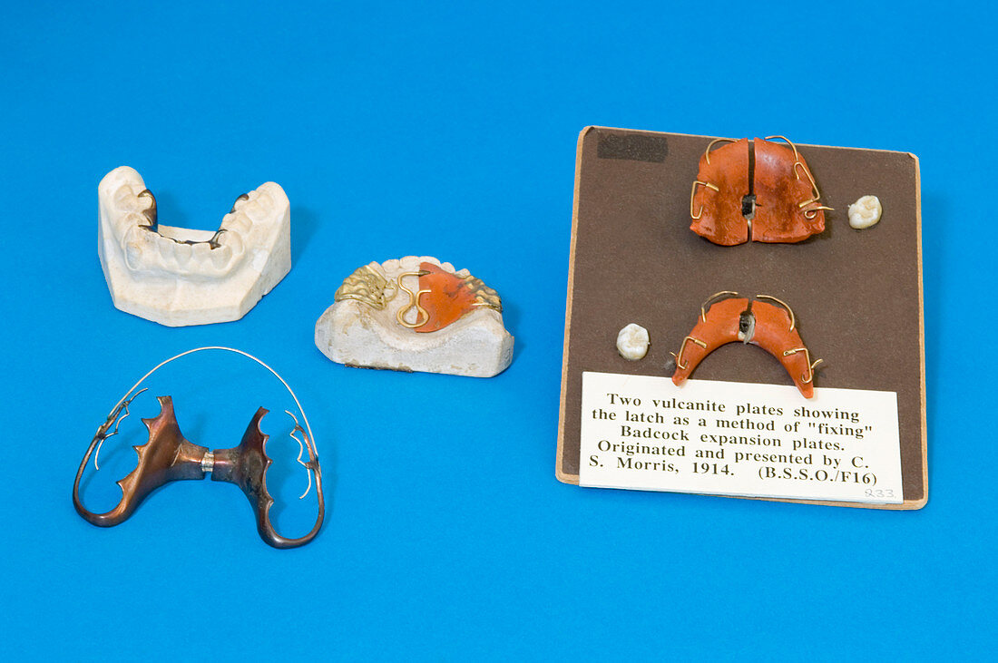 Historical orthodontic plates
