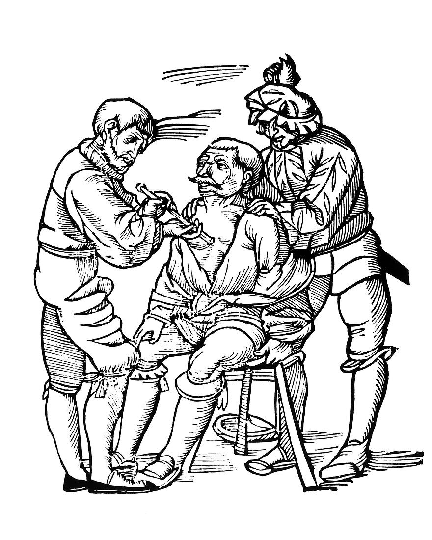 Woodcut of a wounded man being treated