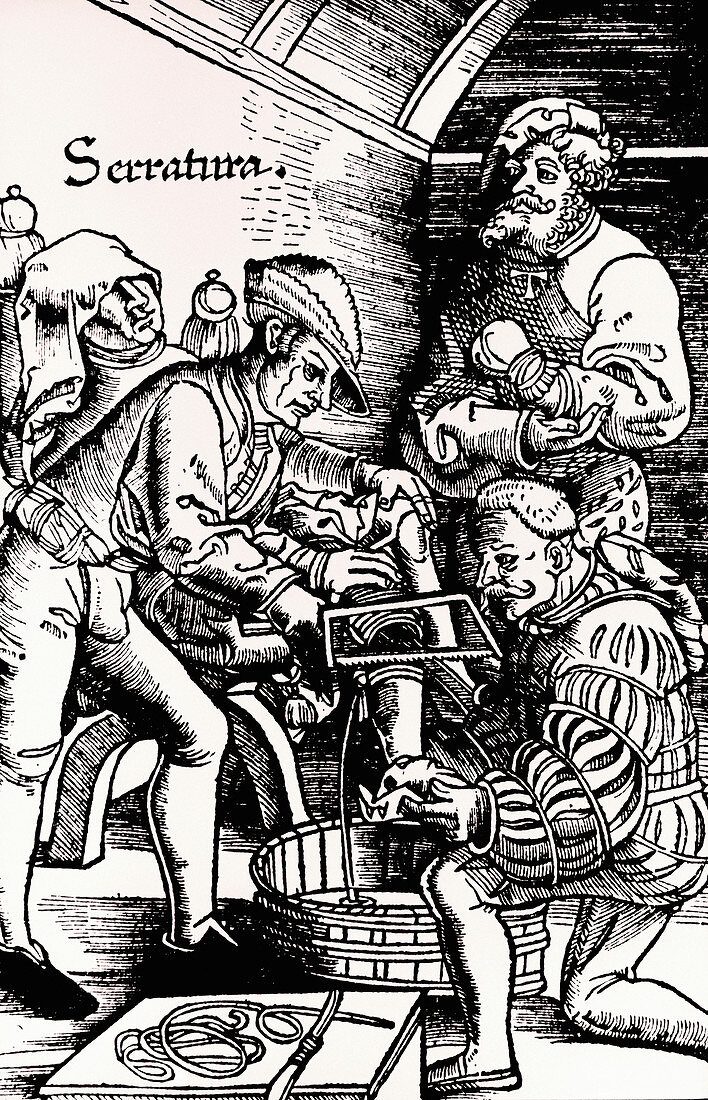 16th century woodcut showing leg amputation