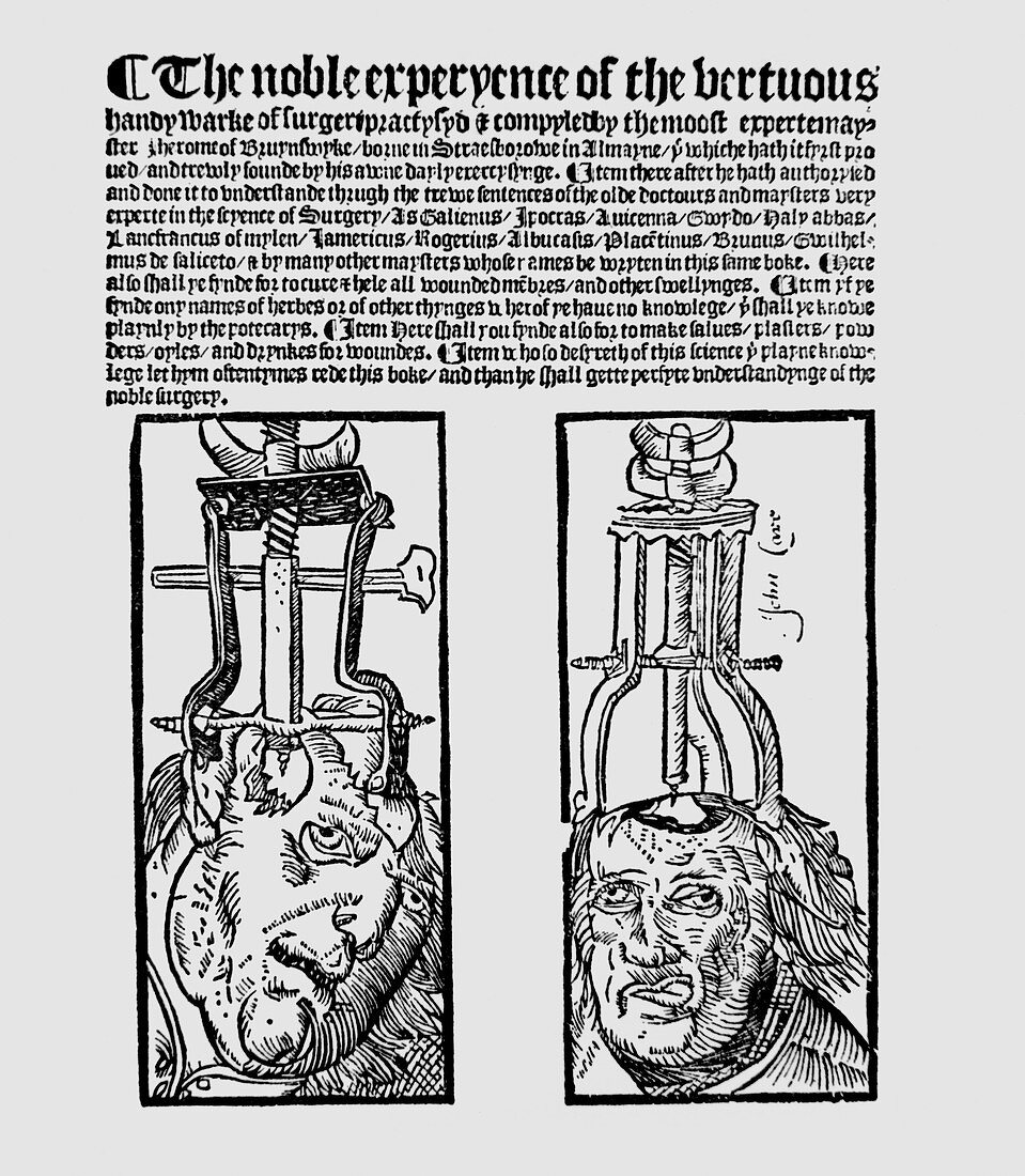 16th century surgery book by Jerome of Brunswick