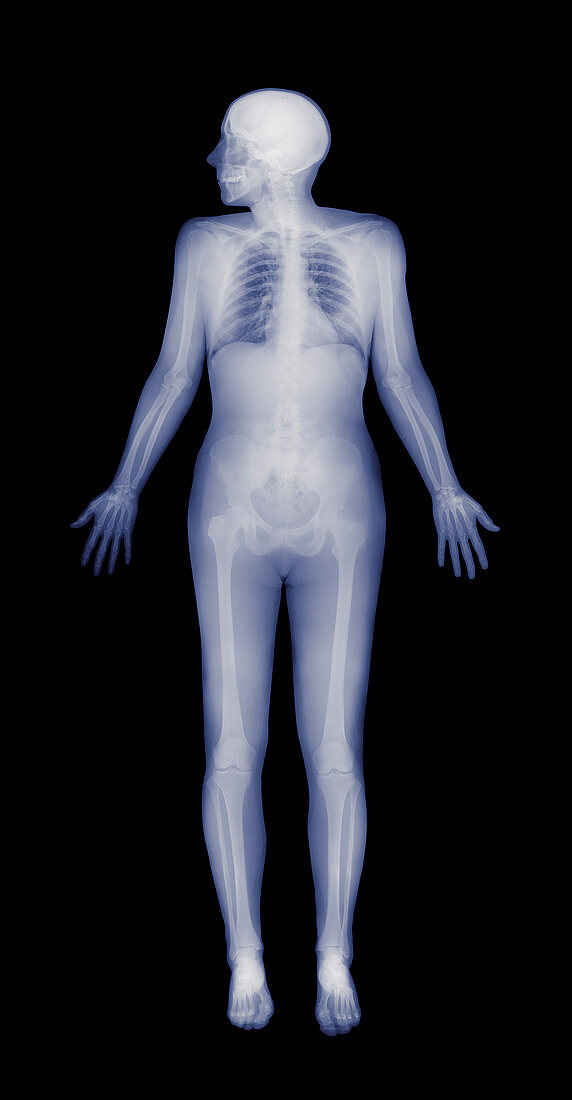 Female skeleton,X-ray