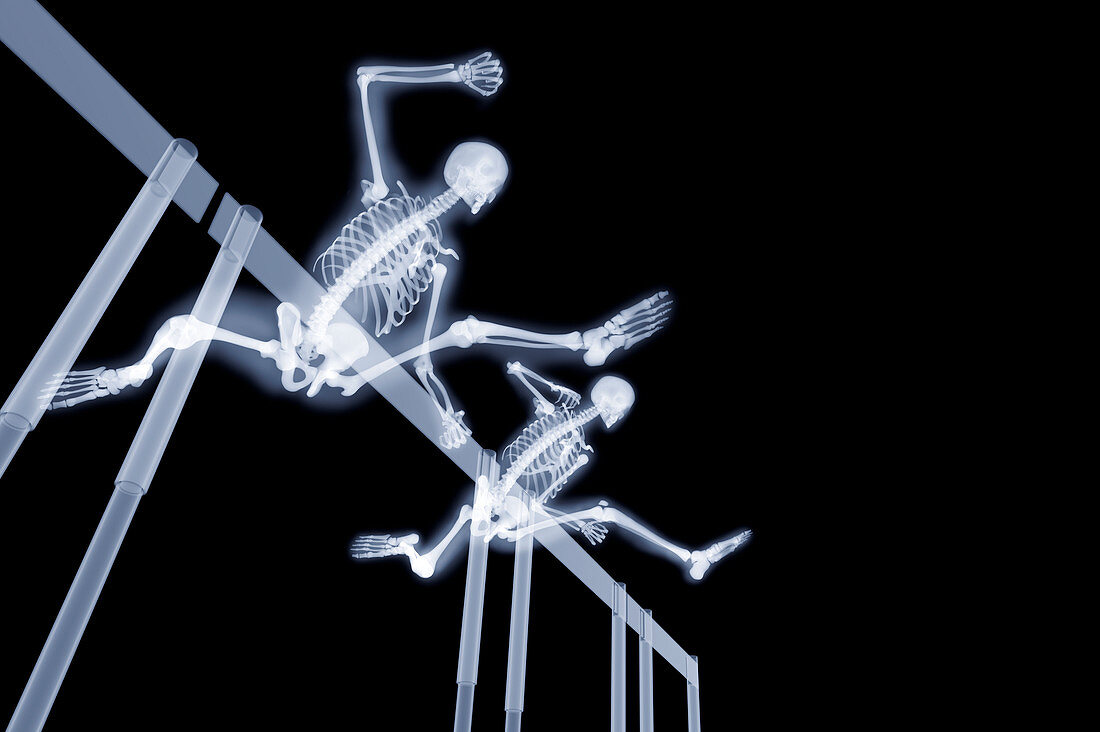 Two hurdlers hurdling,X-ray artwork