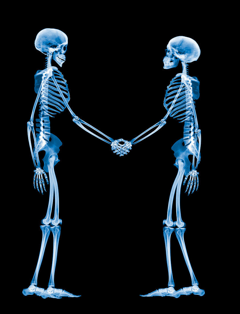 Handshake,X-ray