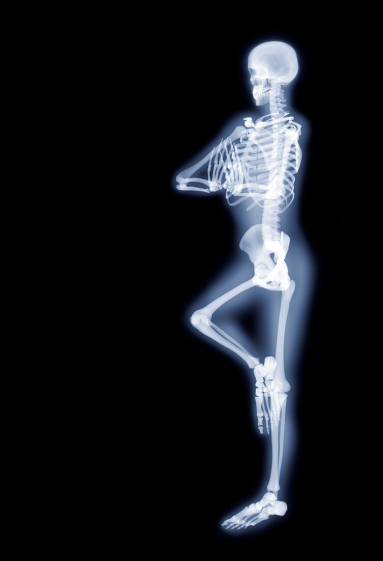 Yoga position,X-ray artwork