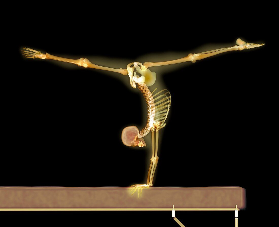 Gymnast balancing on a beam,X-ray artwork
