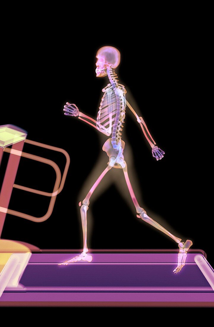 Fitness training,X-ray artwork