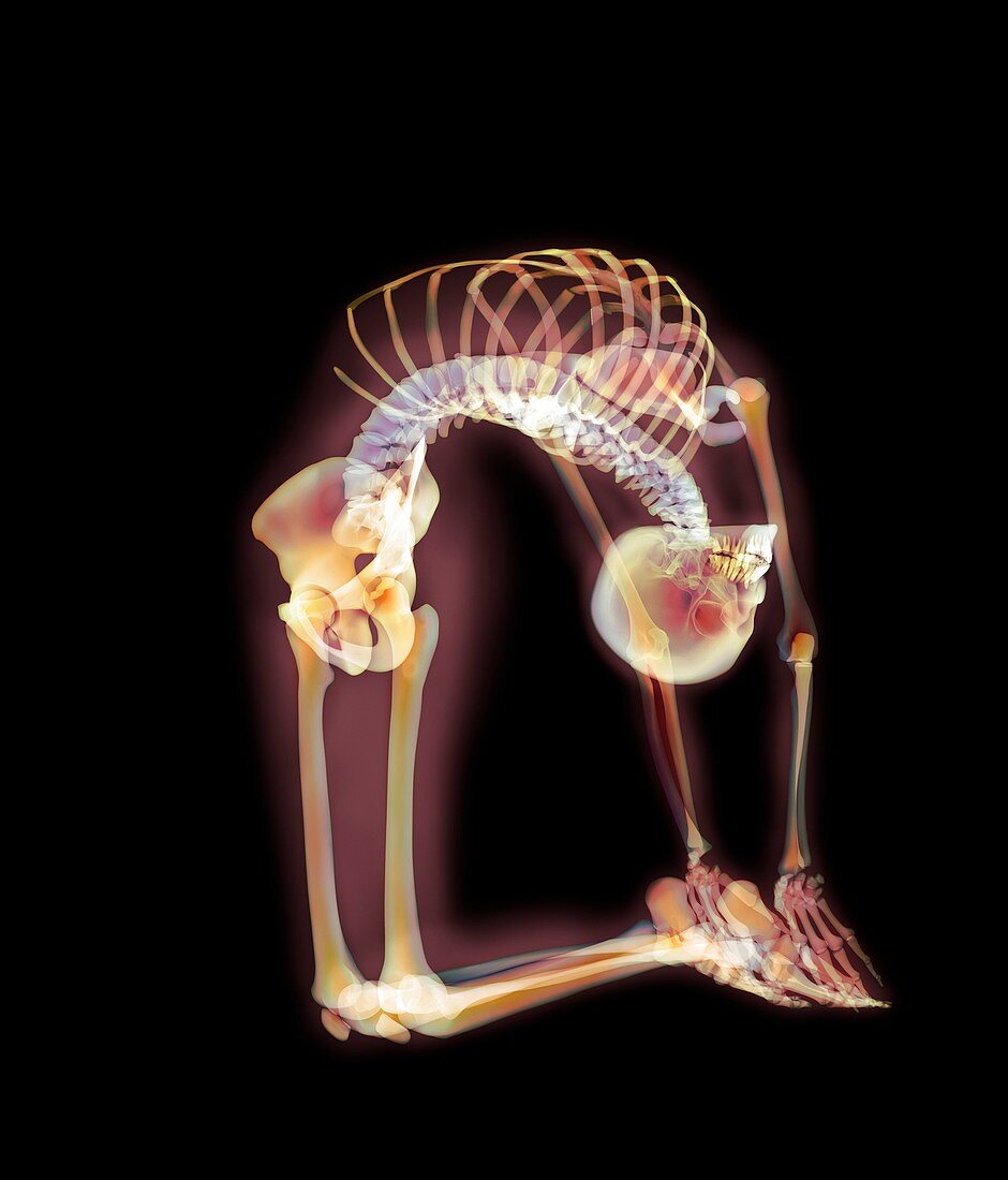 Backward bend,X-ray artwork