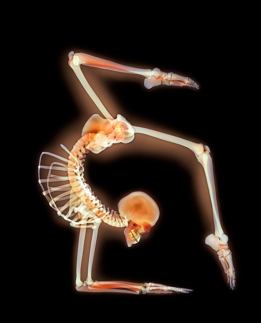 Elbow stand,X-ray artwork