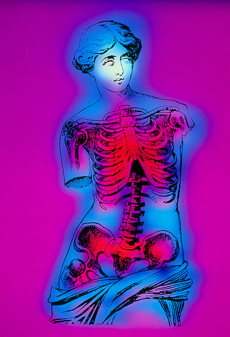 Artwork of human skeleton on Venus de Milo statue