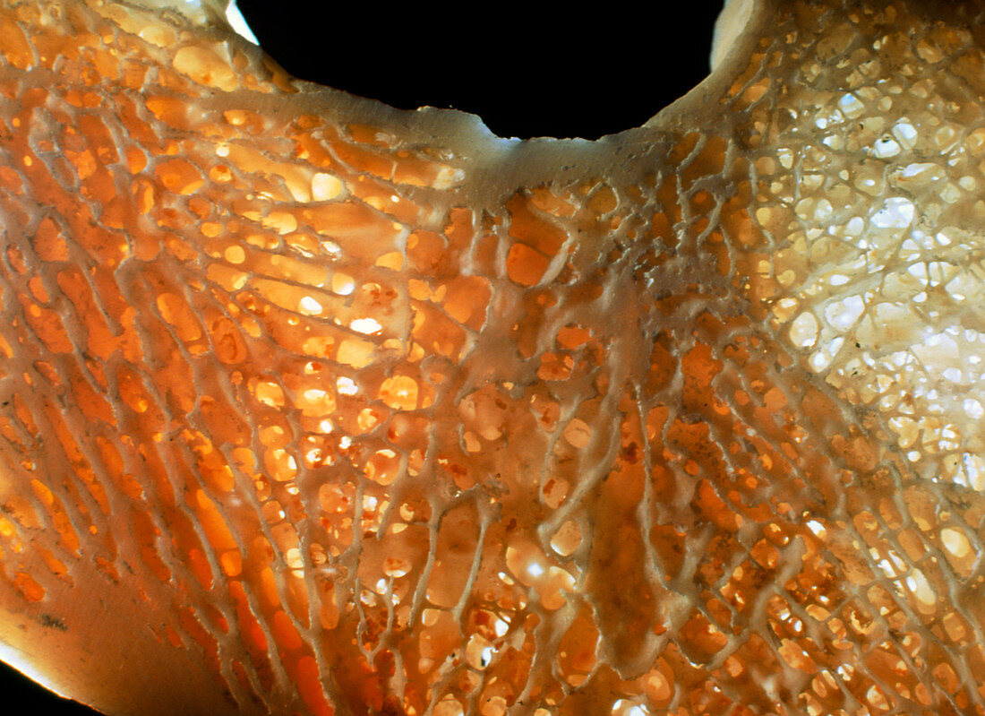 Macrophoto of transverse section of human hip bone