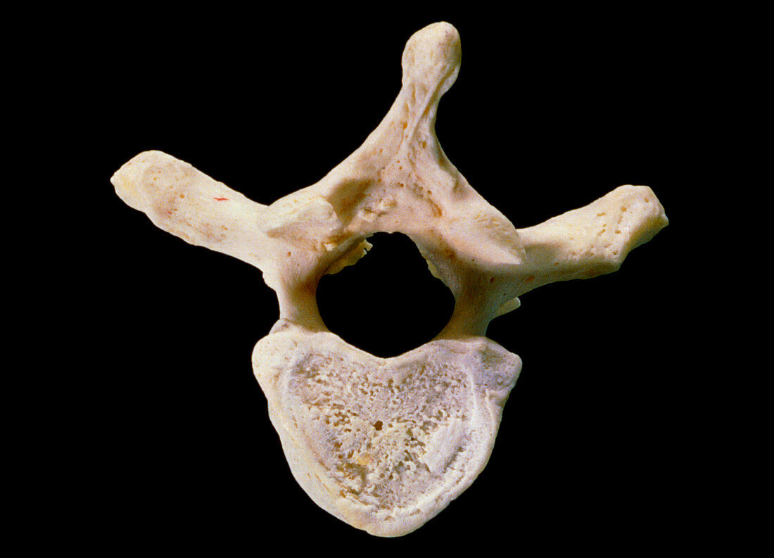 The human fifth thoracic vertebra