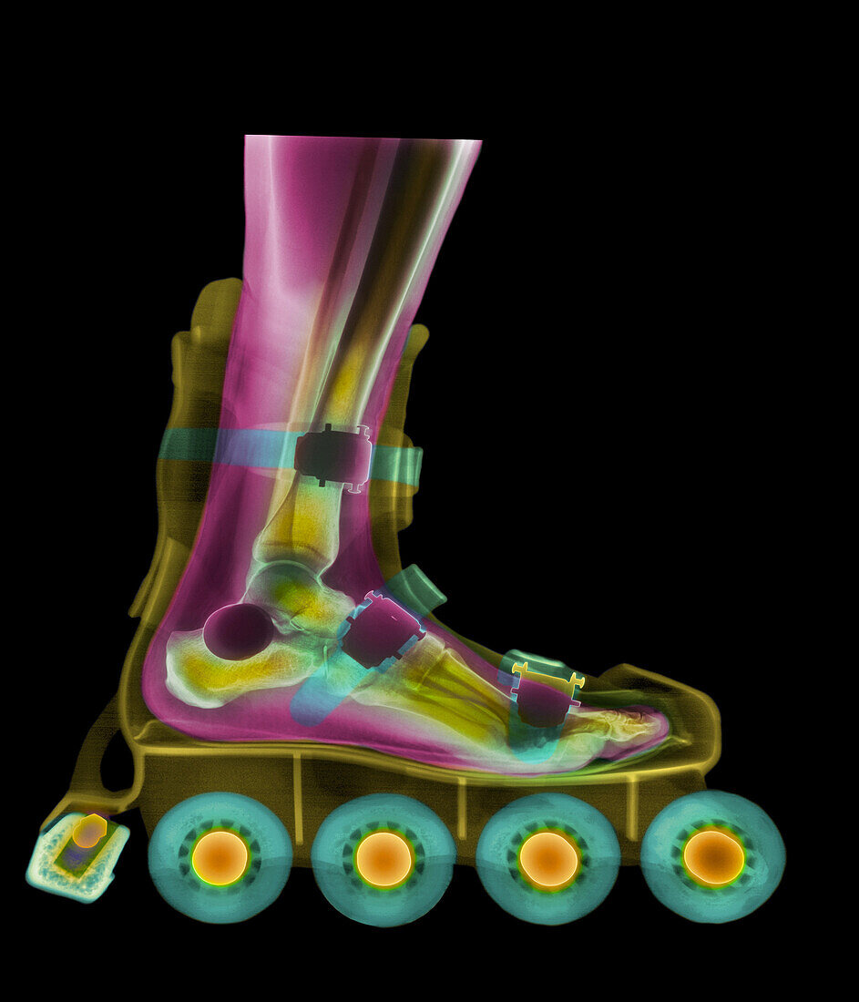 Coloured X-ray of a foot in a roller blade